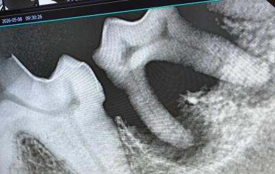 Dentistry X Ray