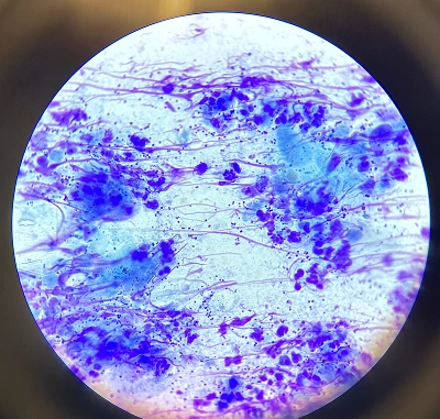 Dermatology Services